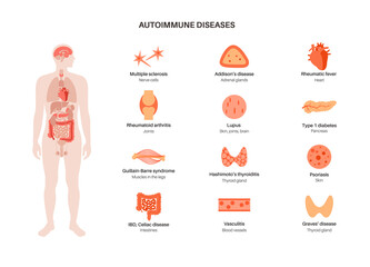 Autoimmune disorders diseases - 505993933