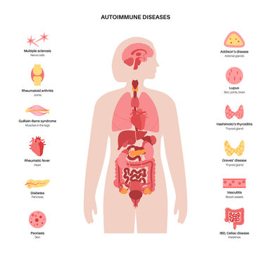Autoimmune disorders diseases