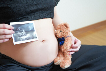 妊婦のお腹にキスするテディベアとエコー写真