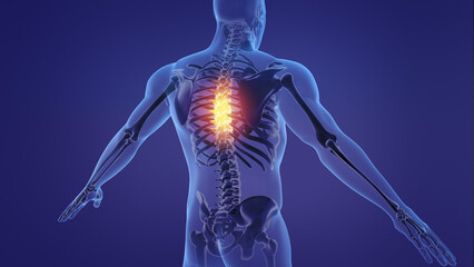 Animation of a painful human spine	
