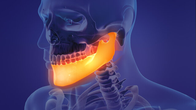 Animation of a painful mandible	