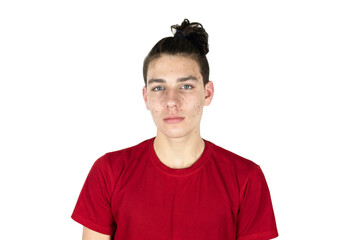 Fototapeta premium Teen guy with pimples and acne on his face on a white background, isolated. The guy is sad because he suffers from skin problems on face, acne has already tormented him