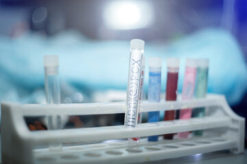 monkeypox virus in vitro in laboratory.