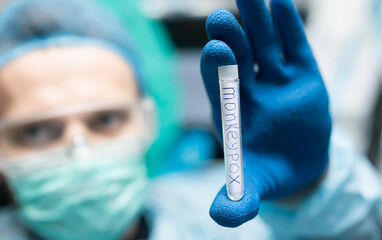 doctor in the laboratory examines the monkeypox virus in a test tube. - obrazy, fototapety, plakaty