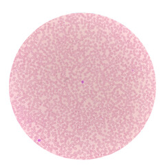 Red blood cells in blood smear on white background.