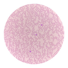 Red blood cells in blood smear on white background.