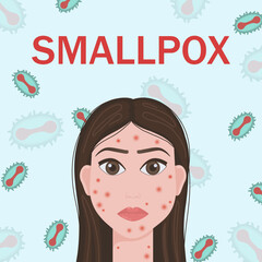 Smallpox virus. Vector illustration of smallpox virus. Monkeypox. Vector illustration of a person affected by smallpox.