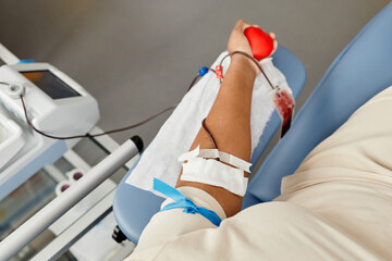 Top view closeup of young woman donating blood and holding red squeeze ball, copy space
