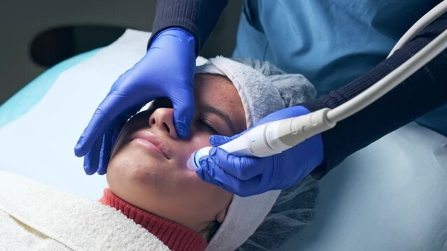 acne treatment for a young girl with aquapure