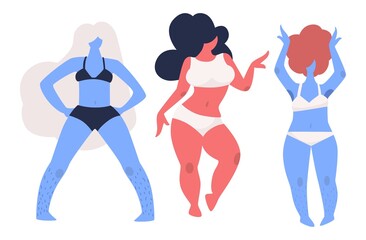 Fototapeta premium Female body positive attitude, women enjoying life