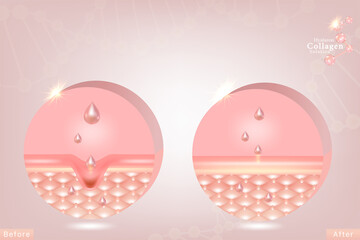 Hyaluronic acid before and after hair and skin solutions ad. pink collagen serum drop over skin cells with cosmetic advertising background ready to use, illustration vector.