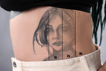 Woman before and after laser tattoo removal procedures on grey background, closeup