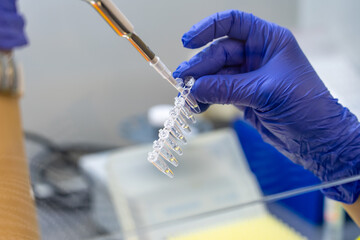 Scientist pipetting sample into vial for DNA testing. Scientist loads samples DNA monkeypox amplification by PCR into plastic strip tubes. Biochemistry specialist works with lab equipment