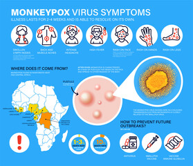Monkeypox virus Symptoms. New cases of Monkeypox virus are reported in Europe and USA. Monkeypox is spreading in the Europe. It cause skin infections. Monkeypox virus detailed infographics - obrazy, fototapety, plakaty