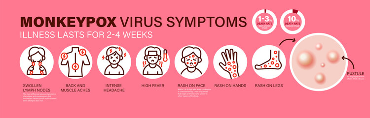 Monkeypox virus Symptoms. New cases of Monkeypox virus are reported in Europe and USA. Monkeypox is spreading in the Europe. It cause skin infections. Monkeypox virus Symptom infographics