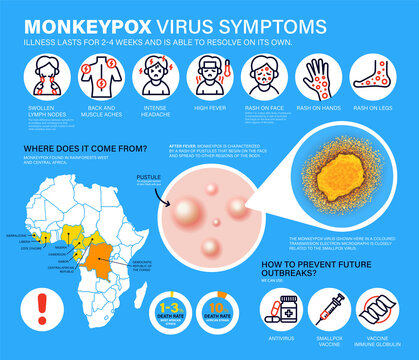 Monkeypox virus Symptoms. New cases of Monkeypox virus are reported in Europe and USA. Monkeypox is spreading in the Europe. It cause skin infections. Monkeypox virus detailed infographics