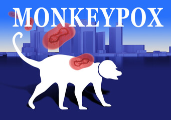 Monkeypox disease. Monkeypox lettering and monkey silhouette. Dangerous infectious disease. Viral smallpox Monkeypox. Danger of infection with strain of fever. City in background. 3d image.