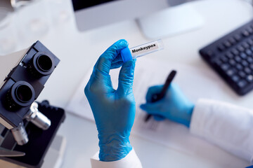 Close Up Of Female Lab Worker Wearing PPE Researching Monkeypox With Microscope