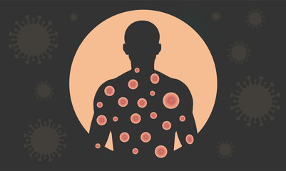 Monkeypox virus. Banner of monkeypox virus on black background. Dangerous disease.