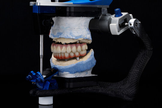 dental articulator with two prostheses in the bite, side view on a black background