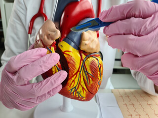 Doctor with scalpel in hand makes an incision on figure of human heart
