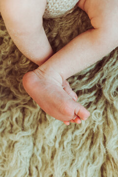 Crop faceless baby with scaling skin on bed