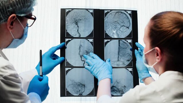 Doctors examining X-ray,brain MRI. Magnetic resonance image of head. Therapist and nurse looking at human blood vessels close-up. Advanced research of body, checkup tomography. 