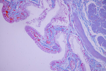 Columnar epithelium of human gall bladder under the microscope in Lab.