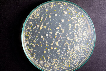 Backgrounds of Characteristics and Different shaped Colony of Bacteria and Mold growing on agar plates from Soil samples for education in Microbiology laboratory.