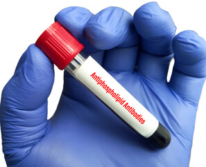 Blood sample tube for Antiphospholipid antibodies(APA) test. To diagnosis Antiphospholipid Syndrome or Hughes syndrome, Connective Tissue Diseases. - obrazy, fototapety, plakaty
