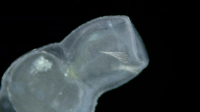 Worm Chaetogaster sp. under the microscope, Class Oligochaeta. Lives in fresh water. In the video, the mouth with which he sucks food like a vacuum cleaner