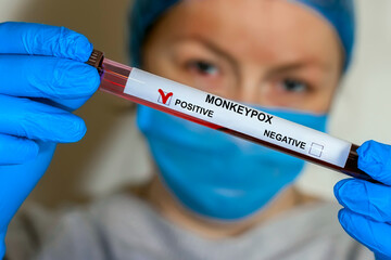 Conceptual photo - testing for monkeypox virus: in the hand there is a test tube with a patient s blood sample, which gave a positive result