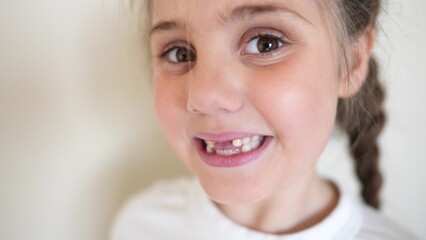 baby no teeth. child smiling no milk a teeth fell out. medicine dentistry happy end family. girl kid close-up smile without teeth. daughter without front teeth portrait lifestyle