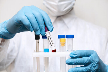 A medical worker holds a tripod with test tubes in his hands,hands in gloves close-up.A sample with...