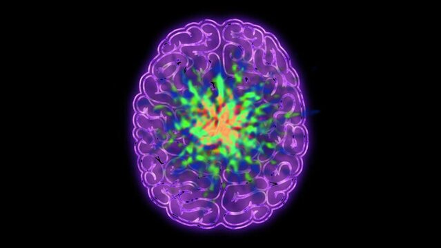Brain Tension, Migraine and Cerebral Pains Abstract Animation. Human Brain in pain with Pressure Pulses .  Stressed cell Nerve Study. Science and Medicine 