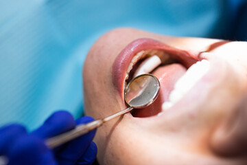 Unrecognizable dentist putting a dental cotton roll using a mouth mirror to a female patient.