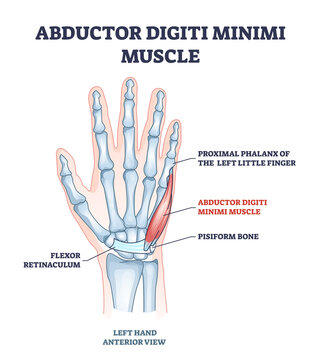 Abductor digiti minimi muscle with hand and palm skeleton outline diagram. Labeled educational scheme with xray flexor retinaculum, proximal phalanx of little finger and pisiform vector illustration.