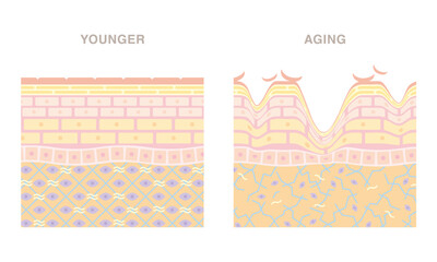Cross section of subcutaneous tissue. Smooth younger skin and wrinkled aging skin. Pale colored illustration in flat cartoon style. - obrazy, fototapety, plakaty