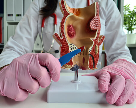 Doctor is holding scalpel anatomy of rectum problem