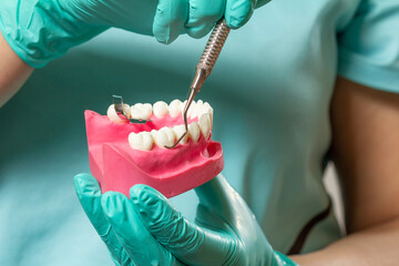 Dentist's hands with layout of the human jaw and dental instrument.