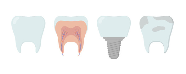 Clean healthy tooth, dental implant, dirty tooth, tooth inside. Template for stomatology or dentistry template.