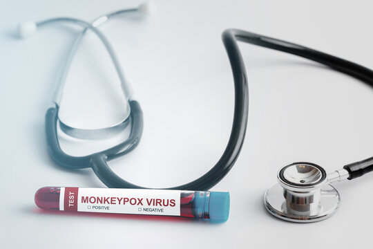 Vacutainer with monkeypox blood sample for testing