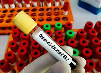 Fototapeta premium Blood sample for SARS-COV-2, Covid-19 Omicron Subvariant test at medical laboratory. BA.2