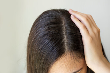 Naklejka premium Young woman shows her black gray hair roots. Hair loss problem. 
