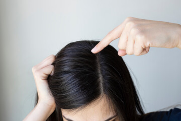 Fototapeta premium Young woman shows her black gray hair roots. Hair loss problem. 
