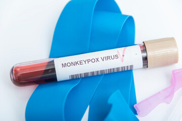 Blood sample tube for Monkeypox virus test.