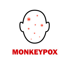 Monkeypox virus concept. Epidemic. World pandemic. Vector clip art illustration.
