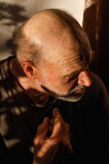 A 60-year-old man with baldness, alopecia, with a hereditary problem of hair loss. He sits indoors