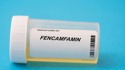 Fencamfamin. Fencamfamin toxicology screen urine tests for doping and drugs