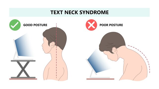 Chin Tuck Head Text neck lift pain nerve deep flexor spine inflamed bad correct poor good phone smart tablet laptop use work from home chiropractor strain upper back Jaw Joint outlet stress injury